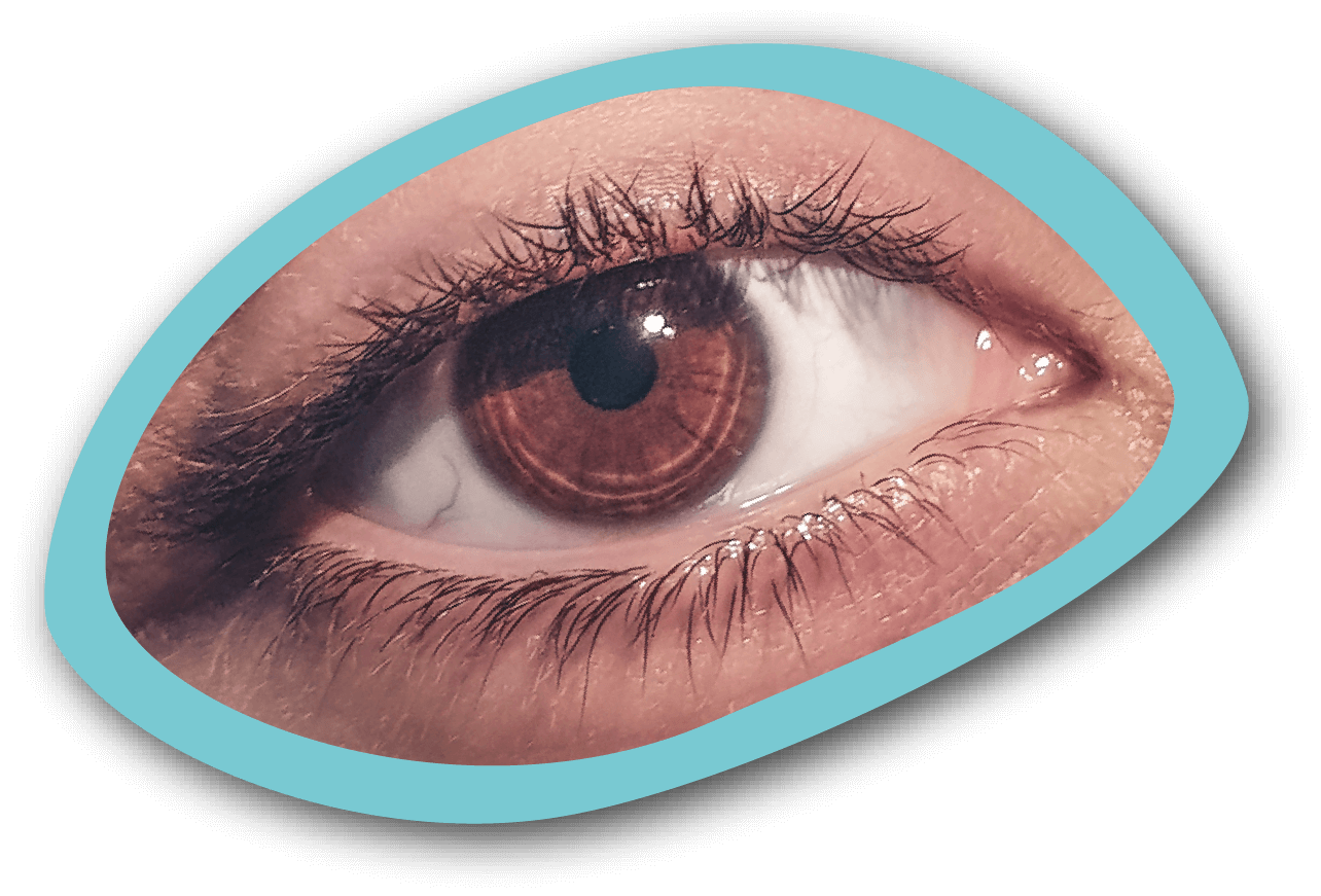 Ojo